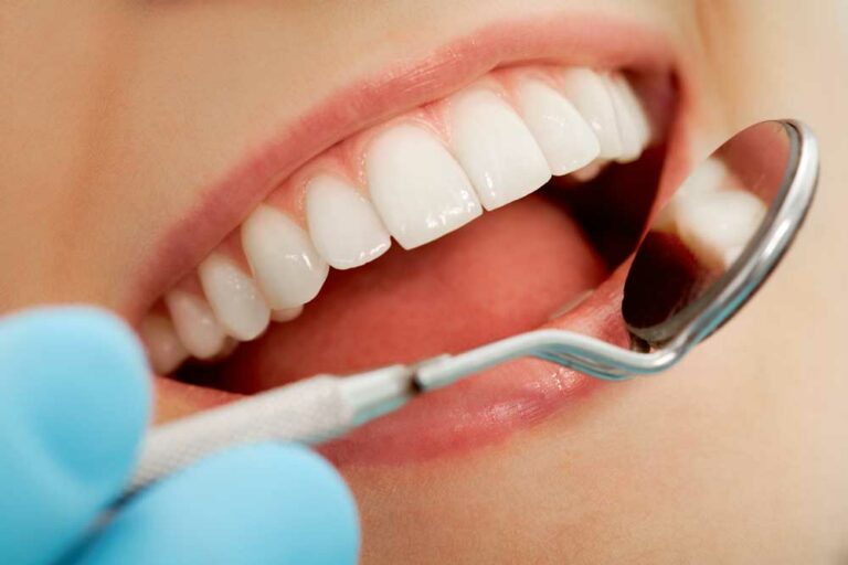 root-canal-cracked-tooth-cracked-tooth-after-root-canal